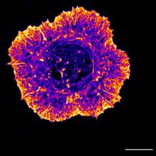 This is a B cell spreading on a stimulatory glass coverslip. I have stained for actin cytoskeleton. The different colours represent different intensities of the actin staining.