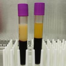 Non-fasting plasma was isolated from healthy patients. You can see different people have different lipid metabolism, resulting in different plasma colors. 